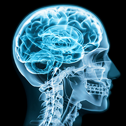 Het menselijke brein en 3d holografie. Afbeelding toont een X-ray van een menselijk hoofd